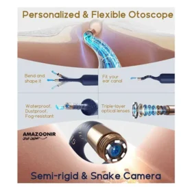 گوش پاک کن هوشمند Bebird مدل EarSight Plus