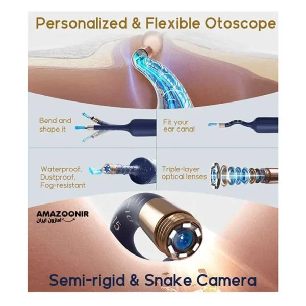 گوش پاک کن هوشمند Bebird مدل EarSight Plus