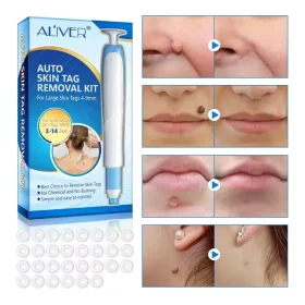 کیت حذف سریع زگیل پوستی ALIVER