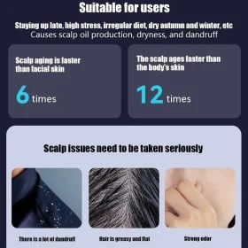 شانه الکتریکی شوره گیر Glomeve