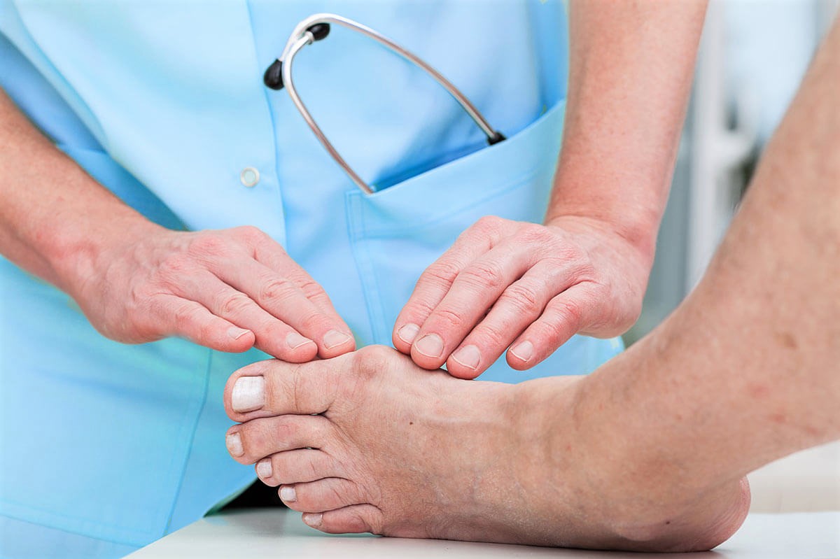 بهترین روش درمان انحراف انگشت شست پا در خانه