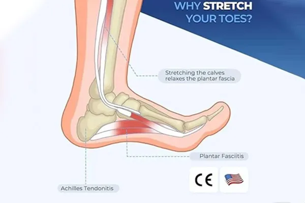 فاسئیت کف پا