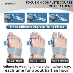 اصلاح کننده انگشت شست پا